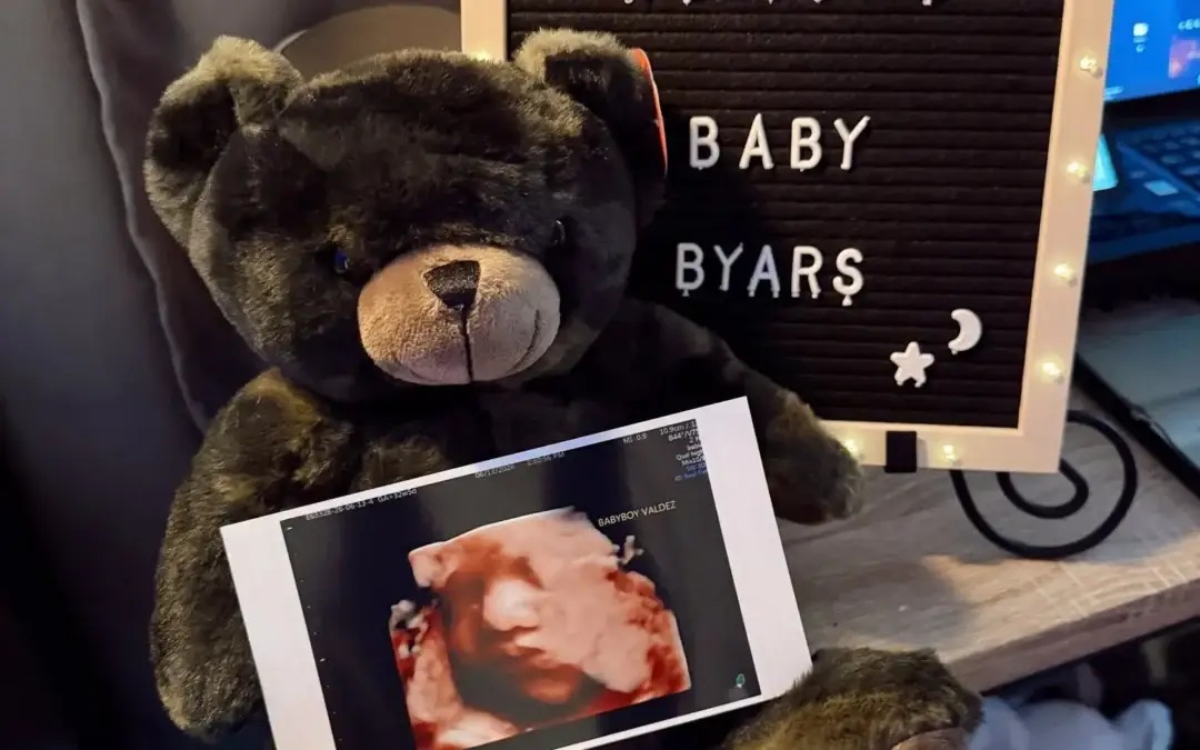 3D Ultrasound Packages and Pricing: What to Know Before You Book