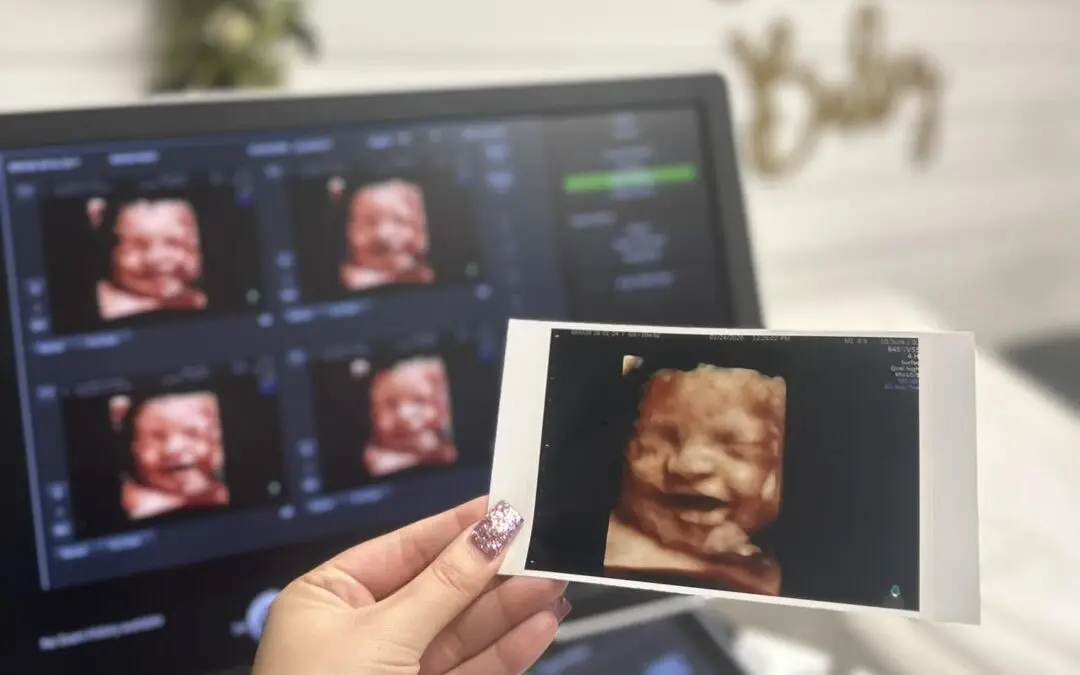 3D Ultrasound Clinic Reviews You Can Trust