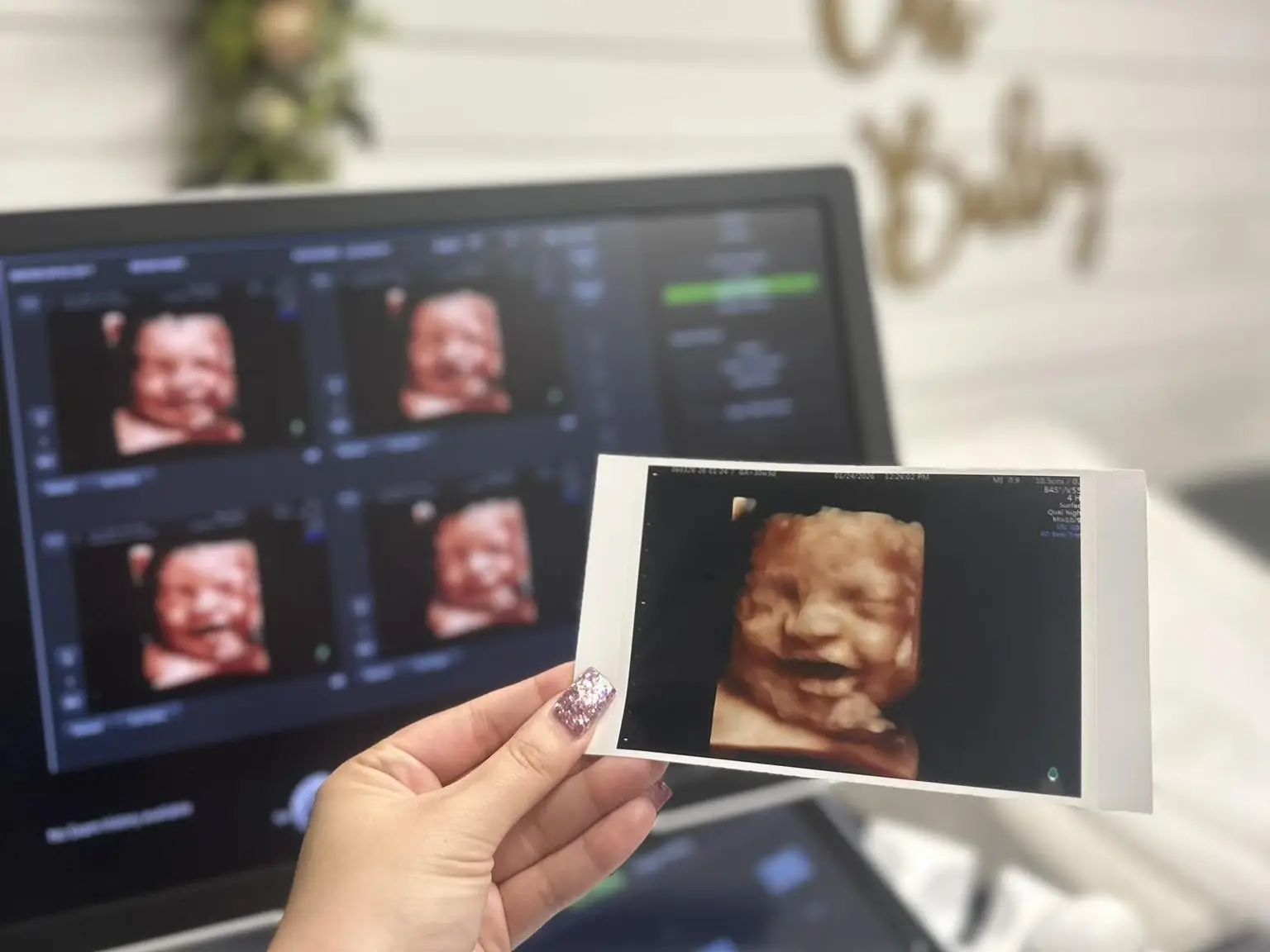 ab830af5-2e52-4504-b29d-a849bb6efca5.webp 3D ultrasound images on screen and printed photo, showcasing elective ultrasound services and baby bonding.