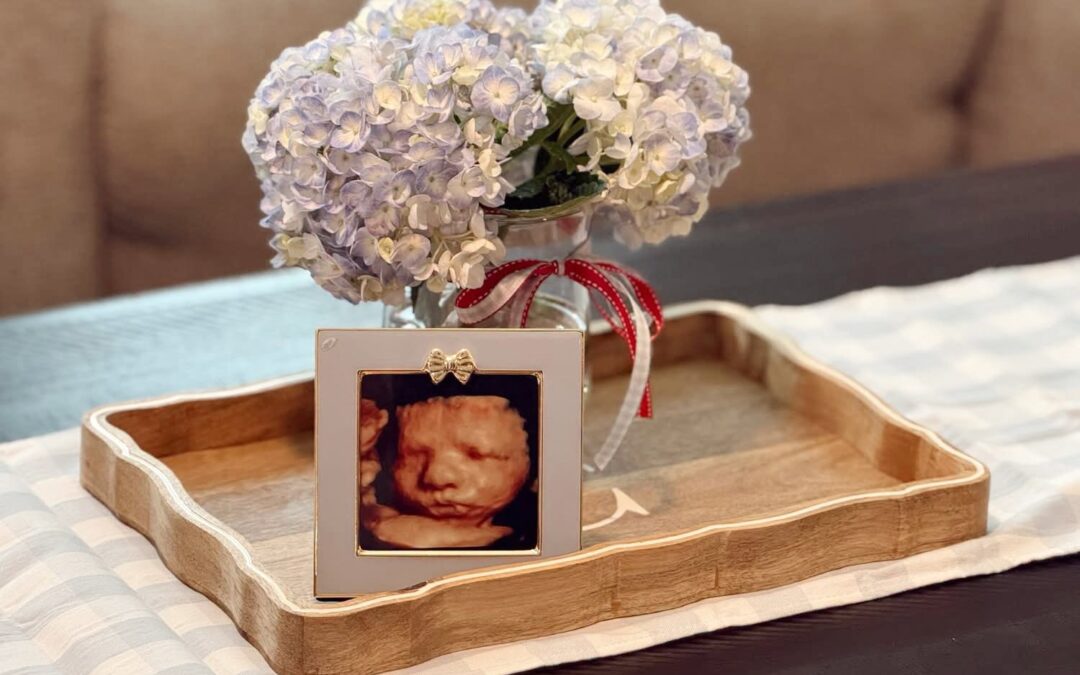 Discover the Emotional Connection: Benefits of 3D/4D Ultrasounds for Expectant Mothers