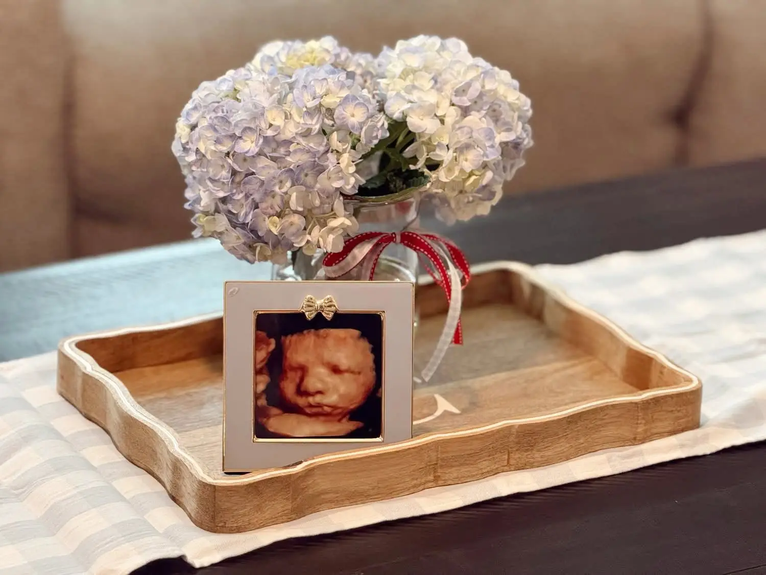 Discover the Emotional Connection: Benefits of 3D/4D Ultrasounds for Expectant Mothers